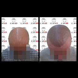 Photo n°21 de J.L EXP'HAIR à Nantes (Tatoueur)