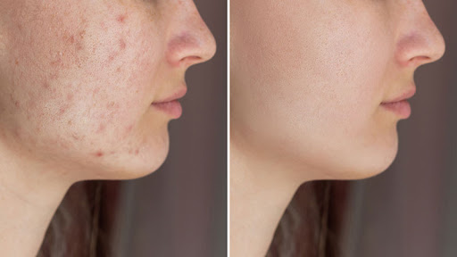 Total Body Laser & Med Spa