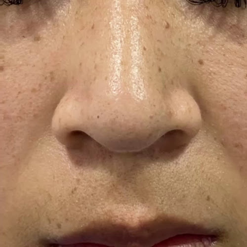 Comentarios y opiniones de Beauty Láser