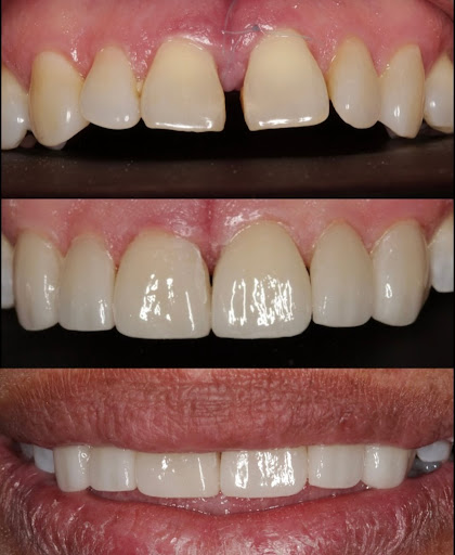 Guno Dental - Thumbnail