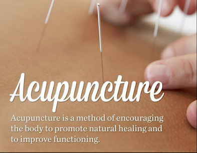 IS ACUPUNCTURE GOOD FOR SOMEONE WITH FIBROMYALGIA?   Many types of chronic pain appear to benefit from acupuncture, so it's not surprising that many individuals with fibromyalgia are interested in trying it. While research on the effectiveness of acupuncture for fibromyalgia symptoms is mixed, the majority of studies suggest that it may be beneficial.  Acupuncture is the insertion of fine needles into strategic points on your body at various depths. They are typically left in place for 20 to 30 minutes before being stimulated further with heat or electricity. When performed by a qualified practitioner, acupuncture poses few risks.  Fibromyalgia can be difficult to treat, and you may need a combination of treatments to control your symptoms. If you're struggling to find relief from your fibromyalgia pain, acupuncture may be worth a shot. However, acupuncture may not be the right treatment for you if your symptoms do not improve within 6 to 8 weeks.   Acupuncture in Omaha, NE Acupuncture is effective, but it cannot deliver immediate results. At Komp Chiropractic and Acupuncture Clinic, we frequently advise patients to undergo more than one acupuncture treatment for optimal results.  Are you ready to discover how acupuncture can help you? Please request an appointment online or by phone at our Omaha, NE office today!  Updates: https://local.google.com/place?id=3911448639036721286&use=posts&lpsid=CIHM0ogKEICAgIDegpy6kgE