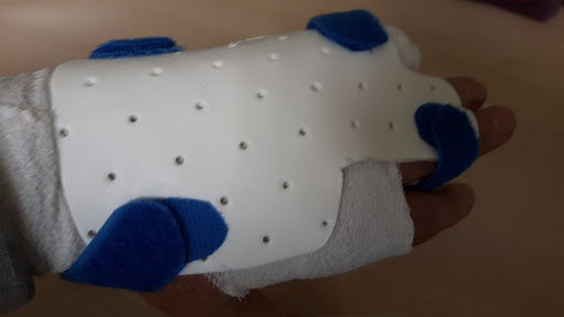 Roland Schroth Therapy - Thumbnail