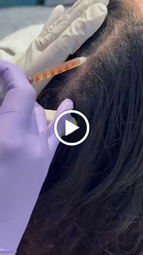 Hair Fall Becoming a Daily Problem? post image