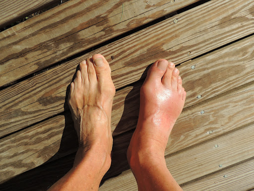 Choice Health - Podiatry - Thumbnail