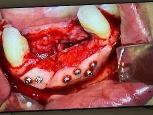 Photo n°5 de Dr Jean-Baptiste Poulet à Tarare (Chirurgien)