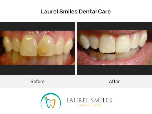 Laurel Smiles Dental Care