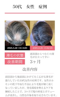 スーパースカルプ発毛センター くまなん店