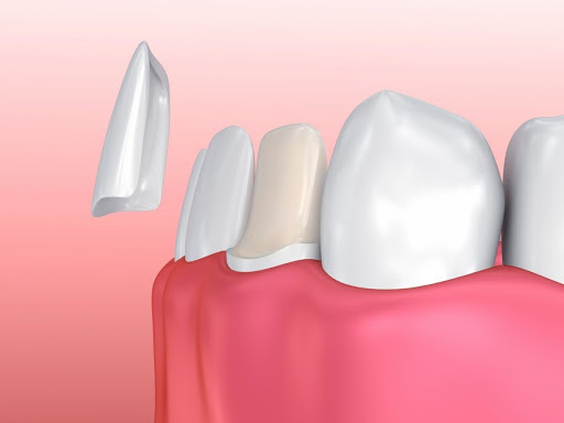 http://www.dentalclinicahmedabad.in/