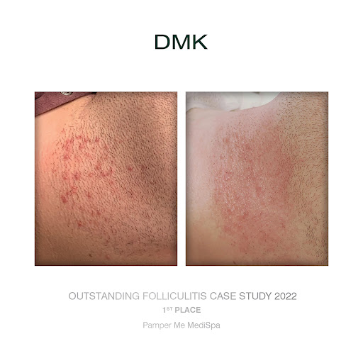SKN | Pamper Me MediSpa - Thumbnail