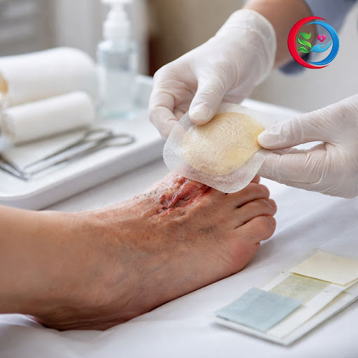 Living with diabetes means even a small wound can turn serious if not treated correctly. At Shifa… post image
