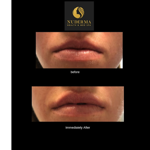 Nuderma Health & Med Spa