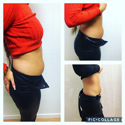 Photo n°11 de CRYOLIFT à Dunkerque (Centre d'amincissement)