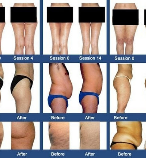 Total Body Image - Visual