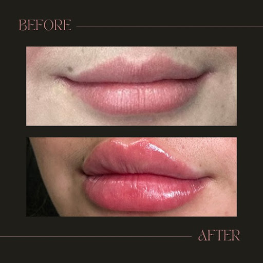 EKG IV Nutrition & Aesthetics / EKG Medspa