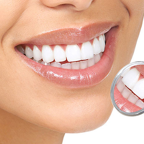 Sherwood House Dental Practice - Loughborough Dentist - Thumbnail