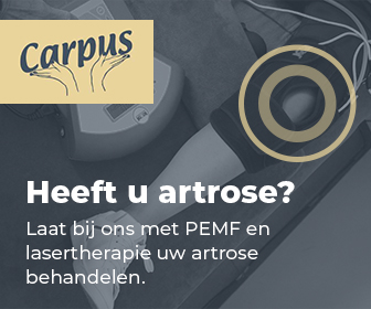 Carpus - Visual