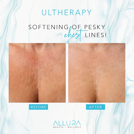 Allura Medspa + Wellness - Wellington Gallery - United States