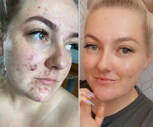 Precision Face and Body Clinic - Thumbnail
