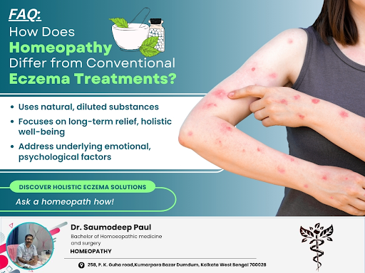 FAQ: How Does Homeopathy Differ from Conventional Eczema Treatments? post image