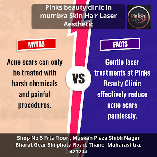 Acne & Scar Treatment post image
