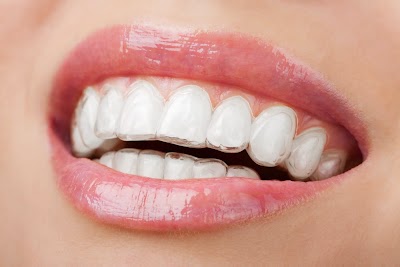 Photos of Special Ortonorm Orthodontics Oral and Maxillofacial Clinic