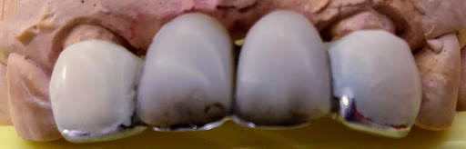 Clínica dental Cázares - Thumbnail