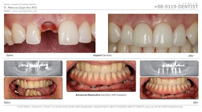 Photos of Bangladesh Center for Dental Implants