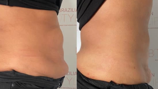 Body Contour Club North West
