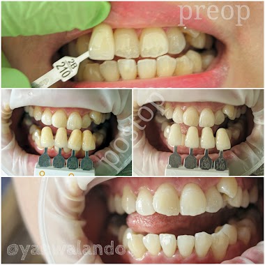 Drg Yan Walando (Glam Dental Studio), Author: Drg Yan Walando (Glam Dental Studio)