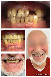 Photo n°7 de Armadent - laboratoire de prothèses dentaires à La Chapelle-sur-Erdre (Chirurgien orthopédiste)