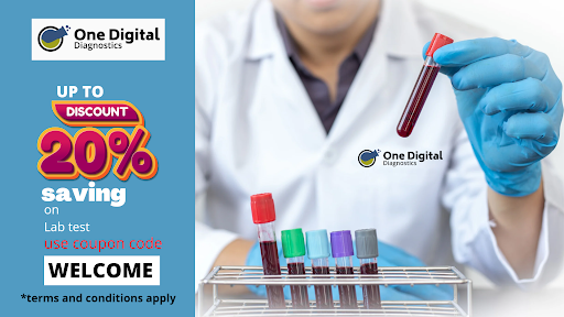 - Free blood sample collection service from the comfort of your own home post image