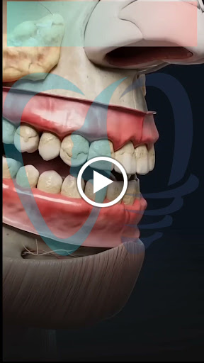 Dental cleaning post image