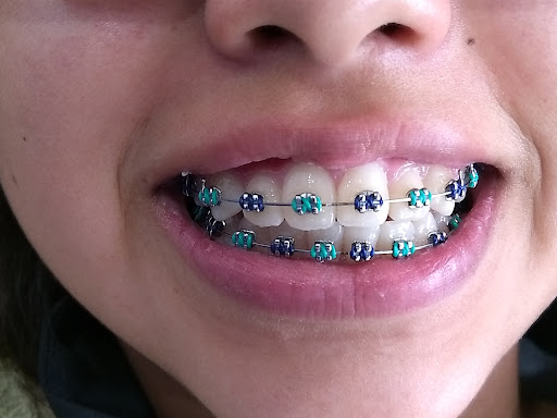 Dentista, odontología general, cosmética dental, implantes ortodoncia - Thumbnail