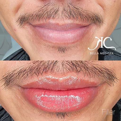 Bella Medspa Arizona