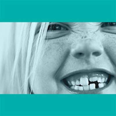 Dental Como - Thumbnail