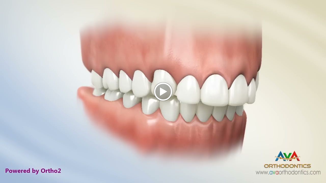 Amrita Medical Center.Dr.Fadi Ata Lahoud. .تقويم الاسنان .مركز عمريتا الطبي.د.فادي عطا لحود Orthodontist-Стоматолог-Ортодонт - صورة 3