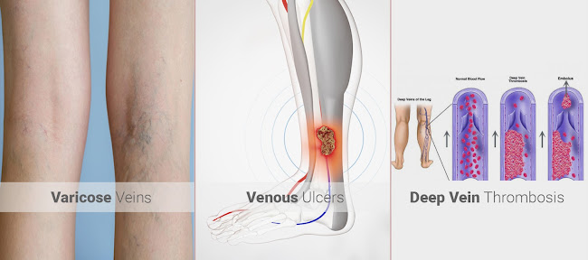 Vein Clinic