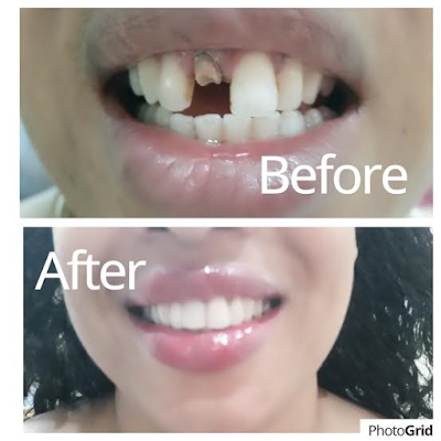 Photos of Happyy Smiles Dental Services