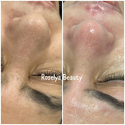 Photo n°11 de Roselya Beauty à Livry-Gargan (Institut de beauté)