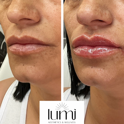 lumi Aesthetics & Wellness