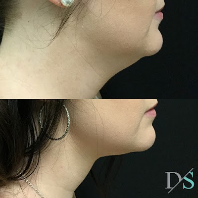 Photos of Dr David Sharp Plastic Surgery Ipswich and The SHARP Cosmetic and Rejuvenation Clinics