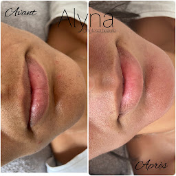 Photo n°21 de Alyna onglesetbeaute à Toulon (Esthéticien)
