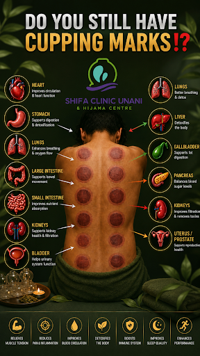 Hijama cupping therapy in warangal  post image