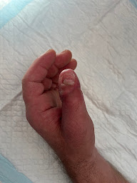 Photo n°6 de 1er SOS MAINS L'Isle-Adam Val d'Oise - 95. Epaule-main (hand-shoulder surgery). Urgence Dimanche 24h/24 Plaie à L'Isle-Adam (Clinique chirurgicale)