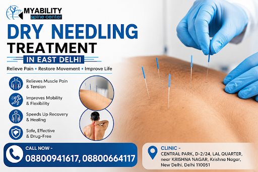 Muscle pain, stiffness, or trigger points slowing you down? Dry Needling Therapy at MyAbility Spi…