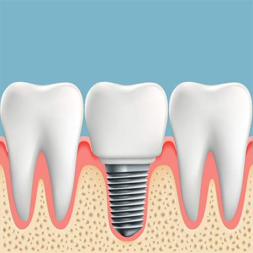 Diamond Dental Service - Thumbnail