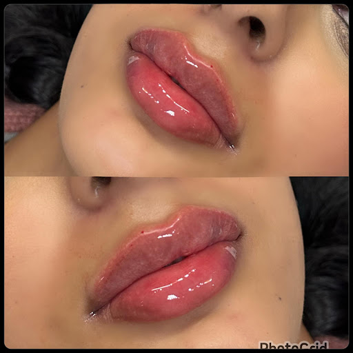 Kamaya Beauty, Aesthetics & Academy - Lip Fillers Batley - Thumbnail