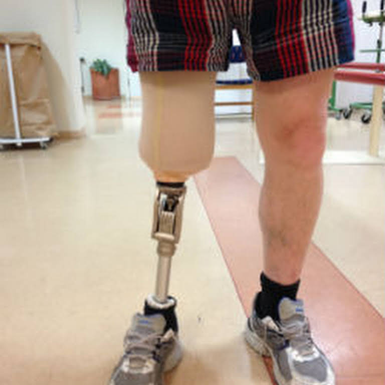 Creative Orthotic and Prosthetic Solutions - Orthotics & Prosthetics ...