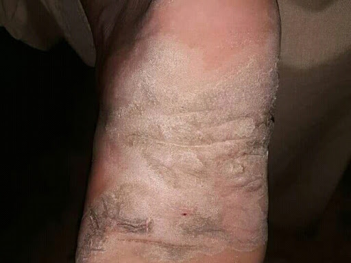 Cured within 3 weeks (Dr Soumya Dey's Clinic desk)  post image