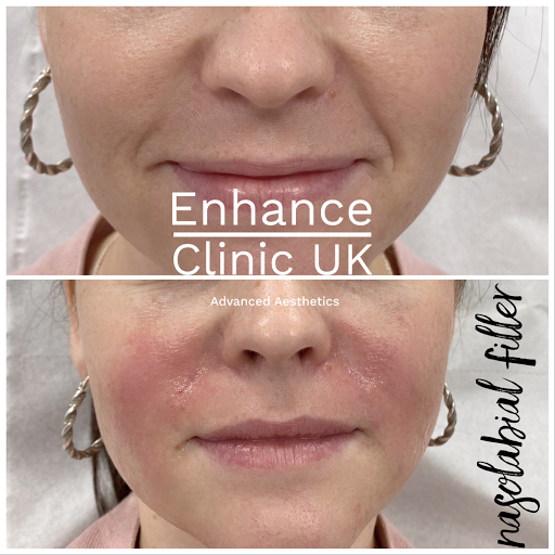 Enhance Clinic UK - Thumbnail